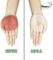 Klean x Hand Wash – Antibacterial & Moisturizing Liquid Soap, 5 Ltr – Gentle, Dermatologist-Approved, Soft on Skin, Suitable for All Skin Types, Soft Hands